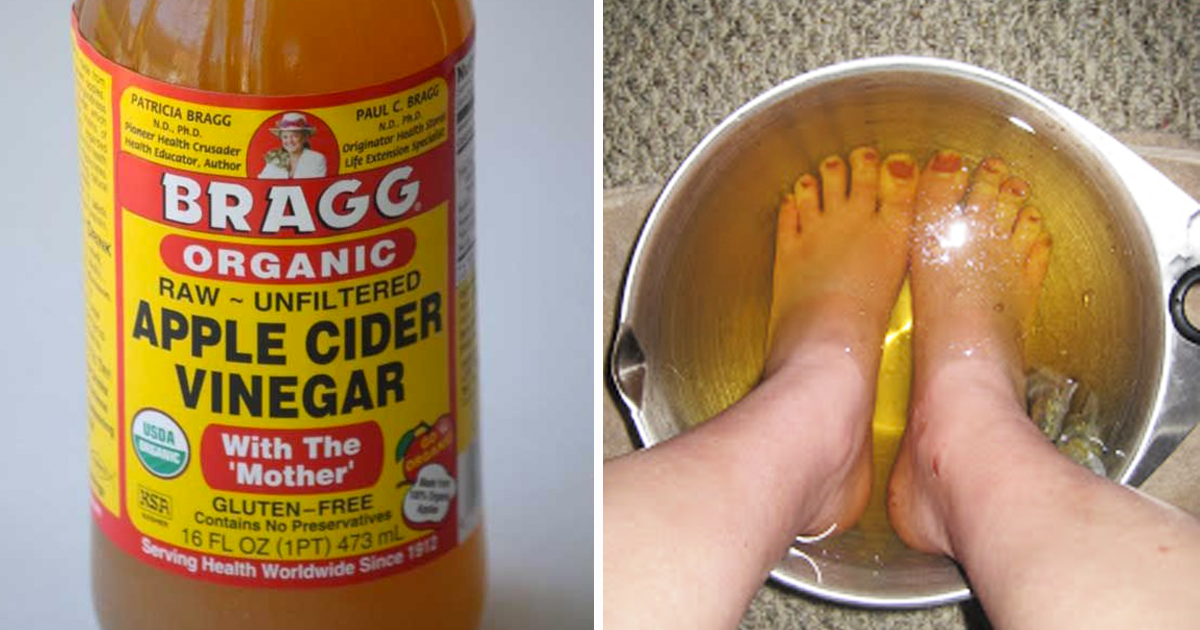 Image result for foot in vinegar