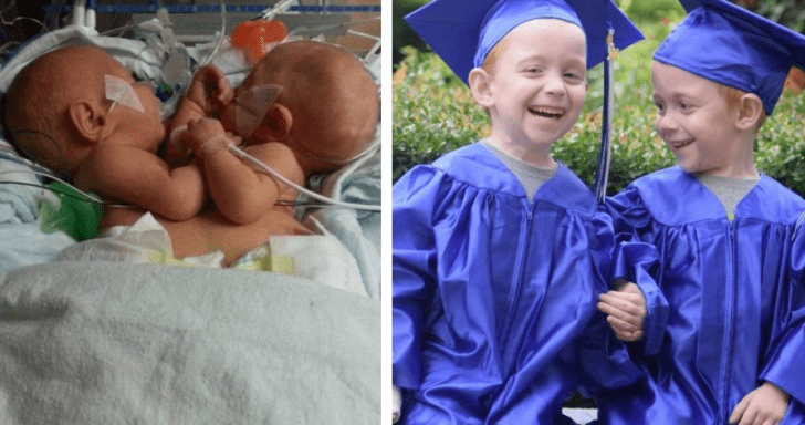 Conjoined Twins Graduate From Pre-Kindergarten